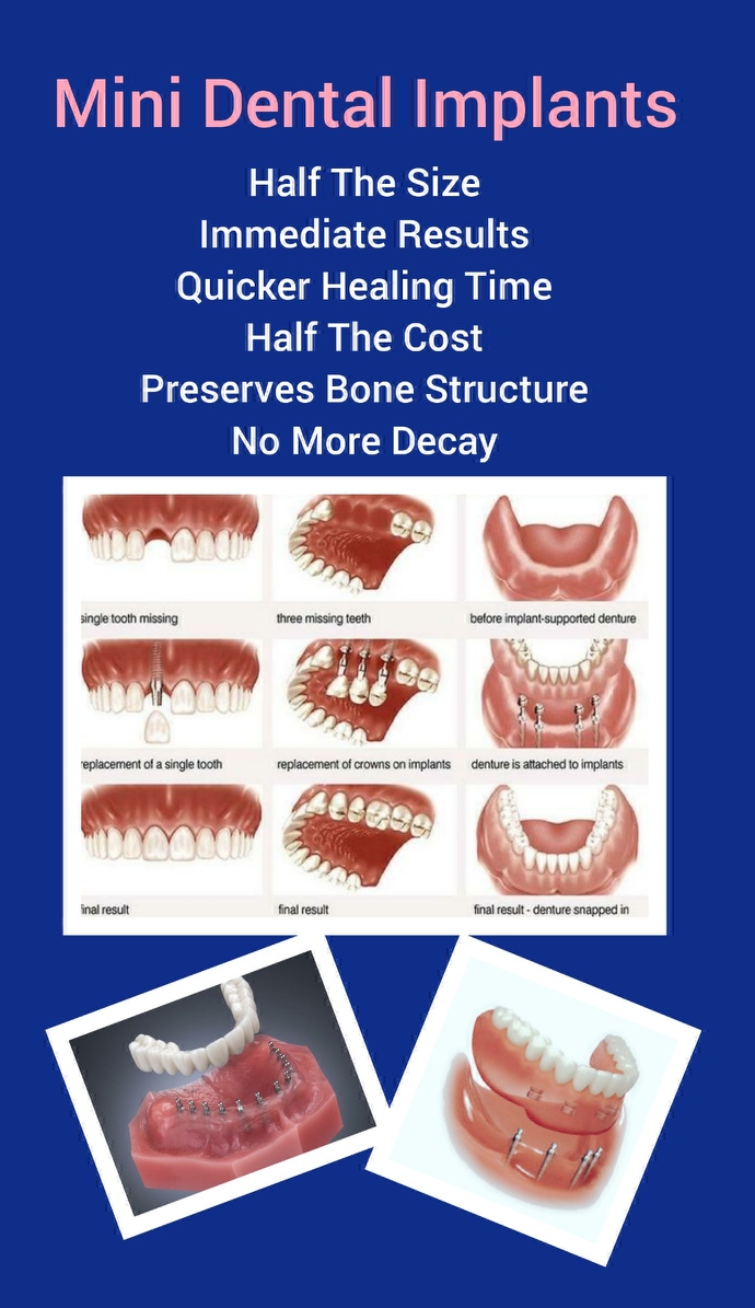 Mini Dental Implant Center photo 3