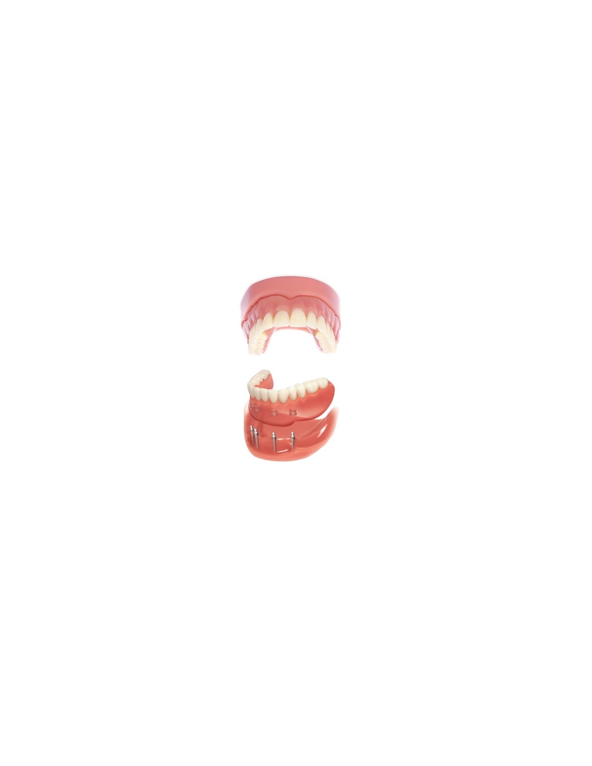 Mini Dental Implant Center photo 4