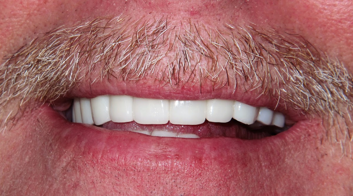 Mini Dental Implant Center photo 5