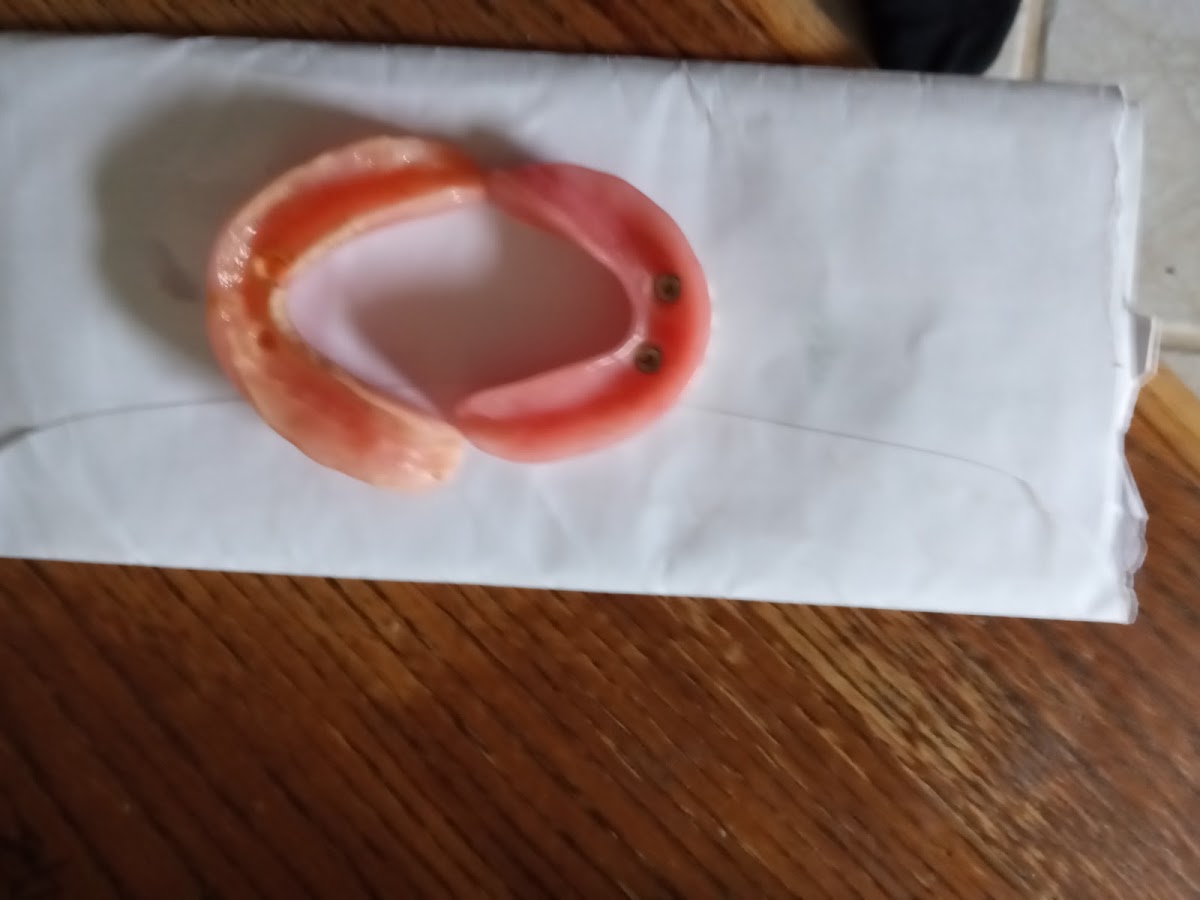 Affordable Dentures & Implants - Cartersville photo 4