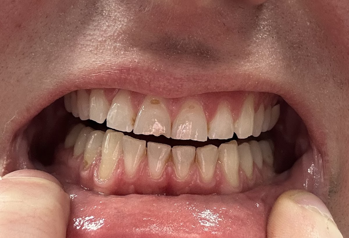 Aspen Dental - Allentown photo 3