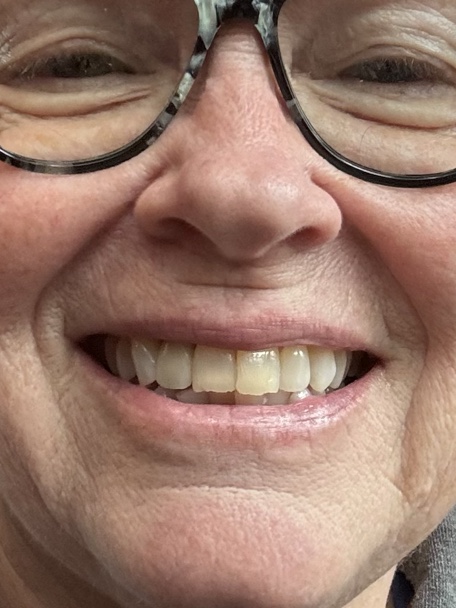 Smile Now Eugene Dentures and Implants photo 6