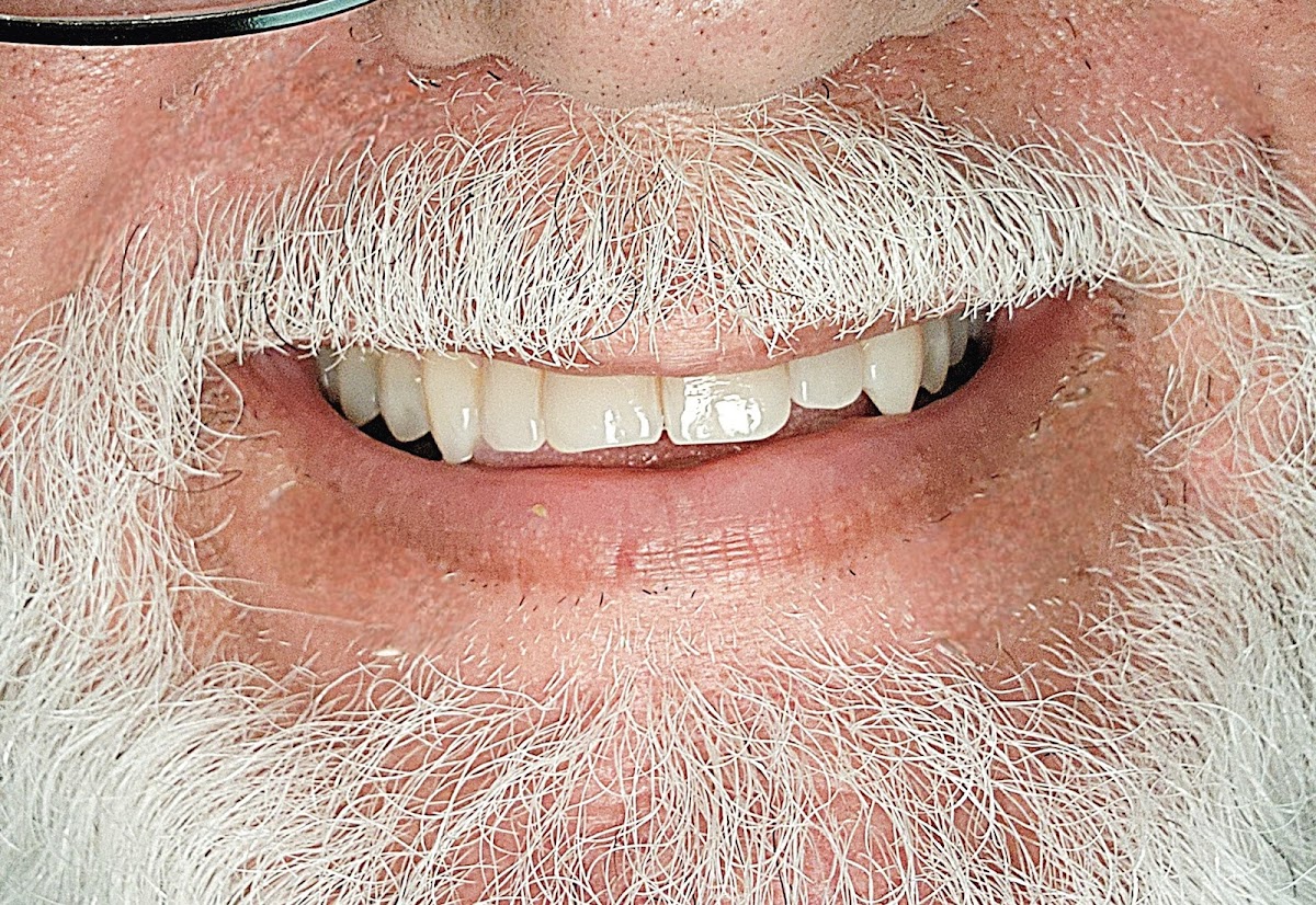 Miami Implant & Family Dentists photo 3