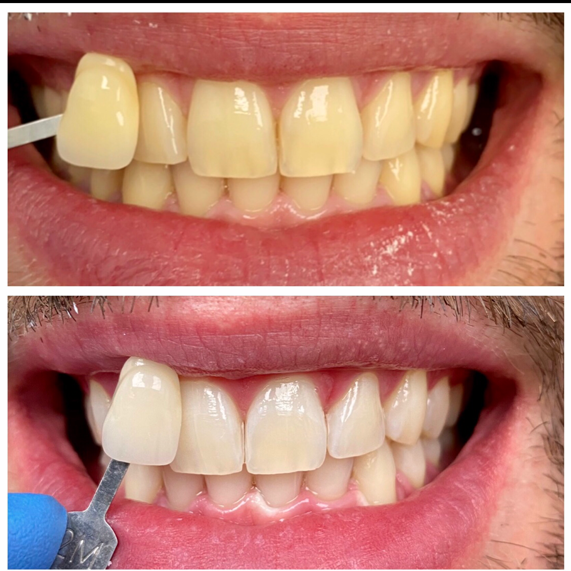 Prime Dental Grand Prairie photo 5