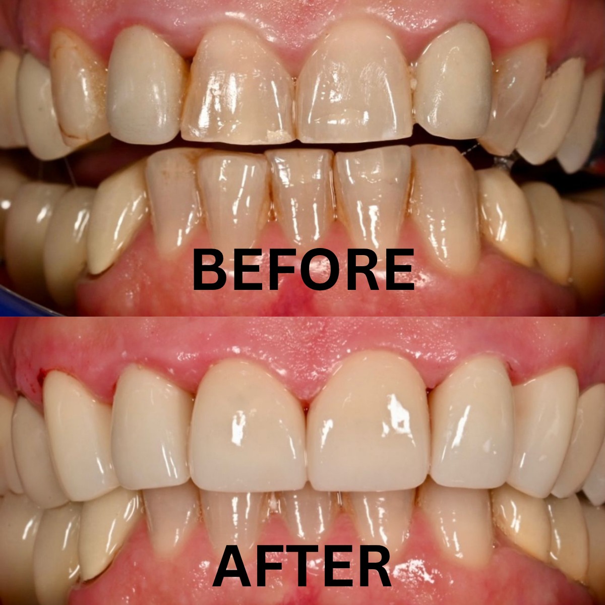 Next Dental Lab photo 1