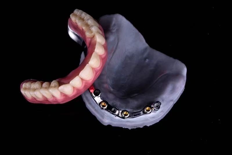 Next Dental Lab photo 6