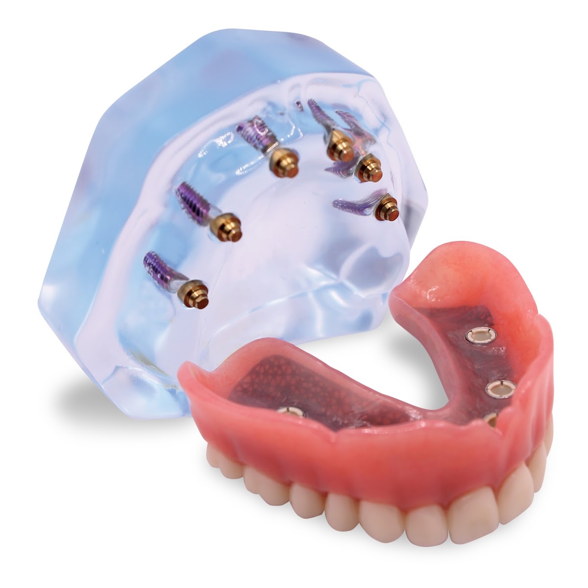 Renew Smiles Dental Implant Center – Macon photo 5