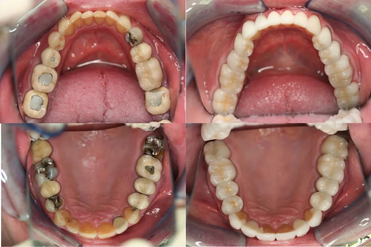 Timbercrest Dental Center photo 6