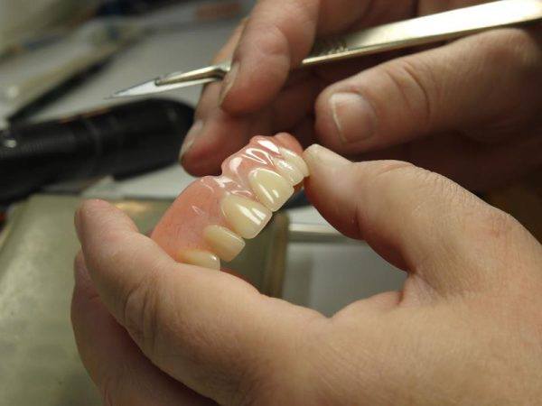 Denture Helper photo 1
