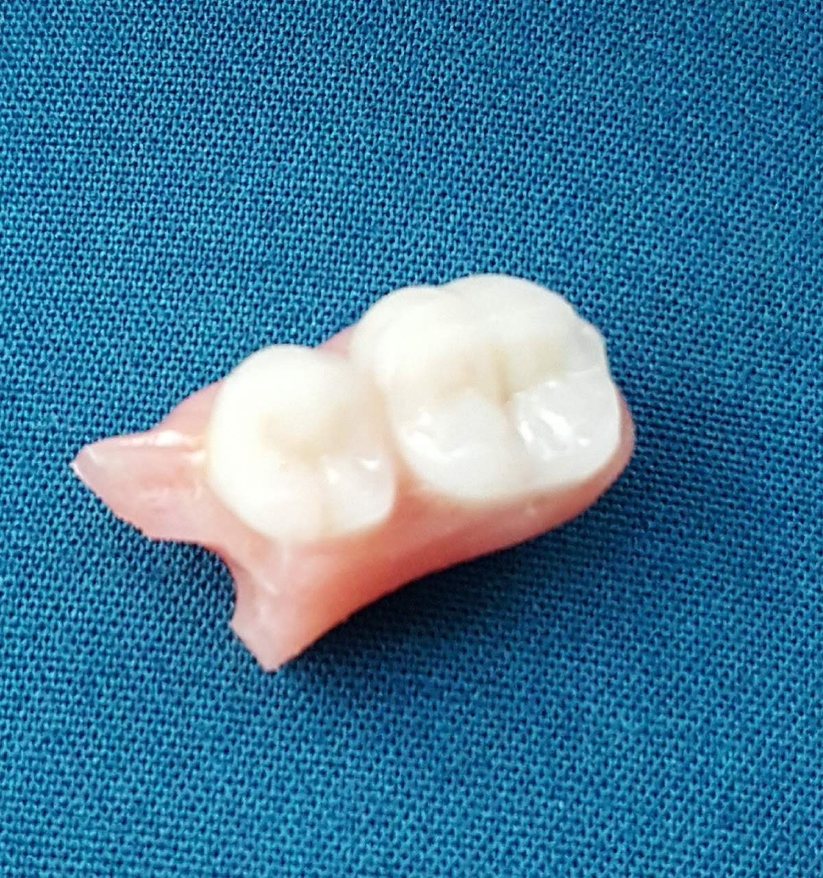 Clearchoice Dental Implant Center - Atlanta photo 4