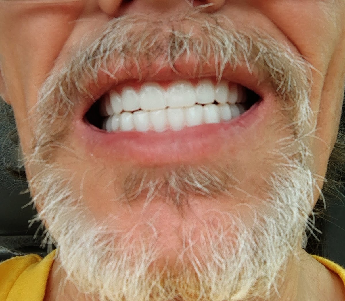 Access Dental, Dentures & Implants photo 2
