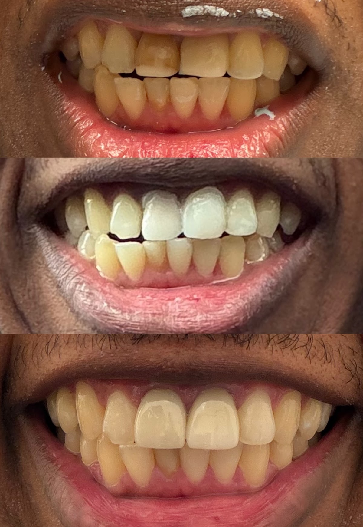 Aspen Dental - Biddeford photo 4