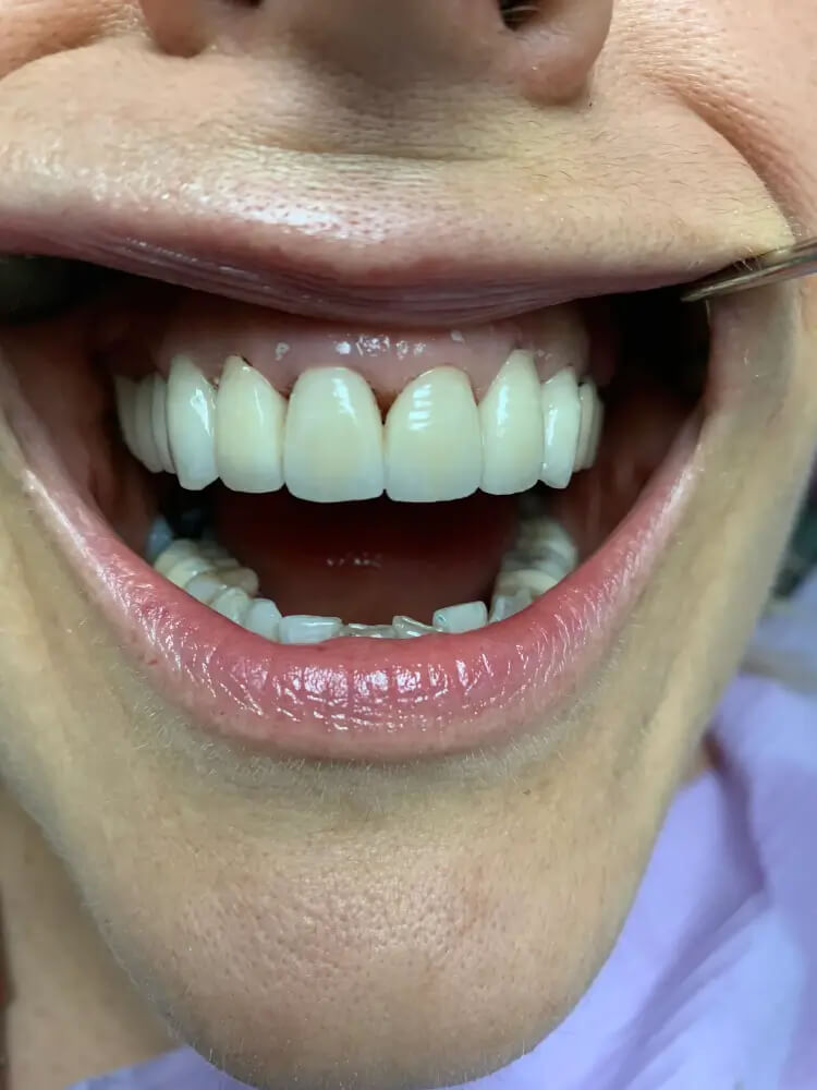 Dentist in Clifton Nj | Prestige Dental Inc photo 3