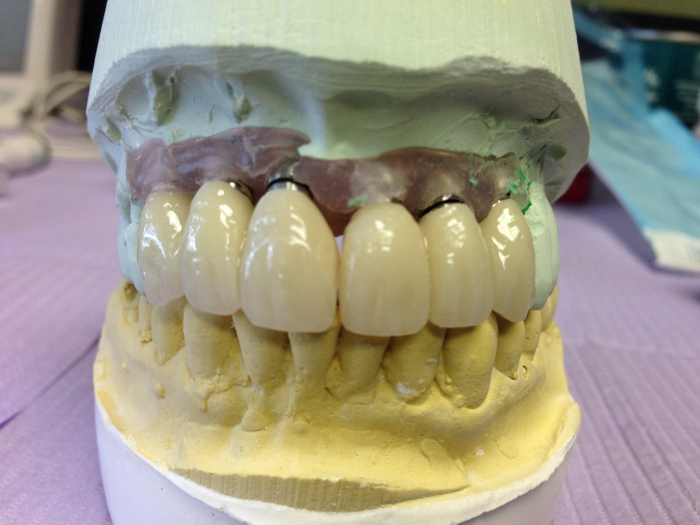 Dentist in Clifton Nj | Prestige Dental Inc photo 4