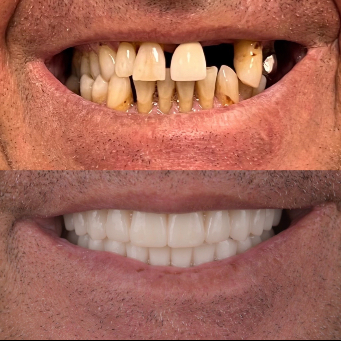 Tampa Dental Implants photo 1