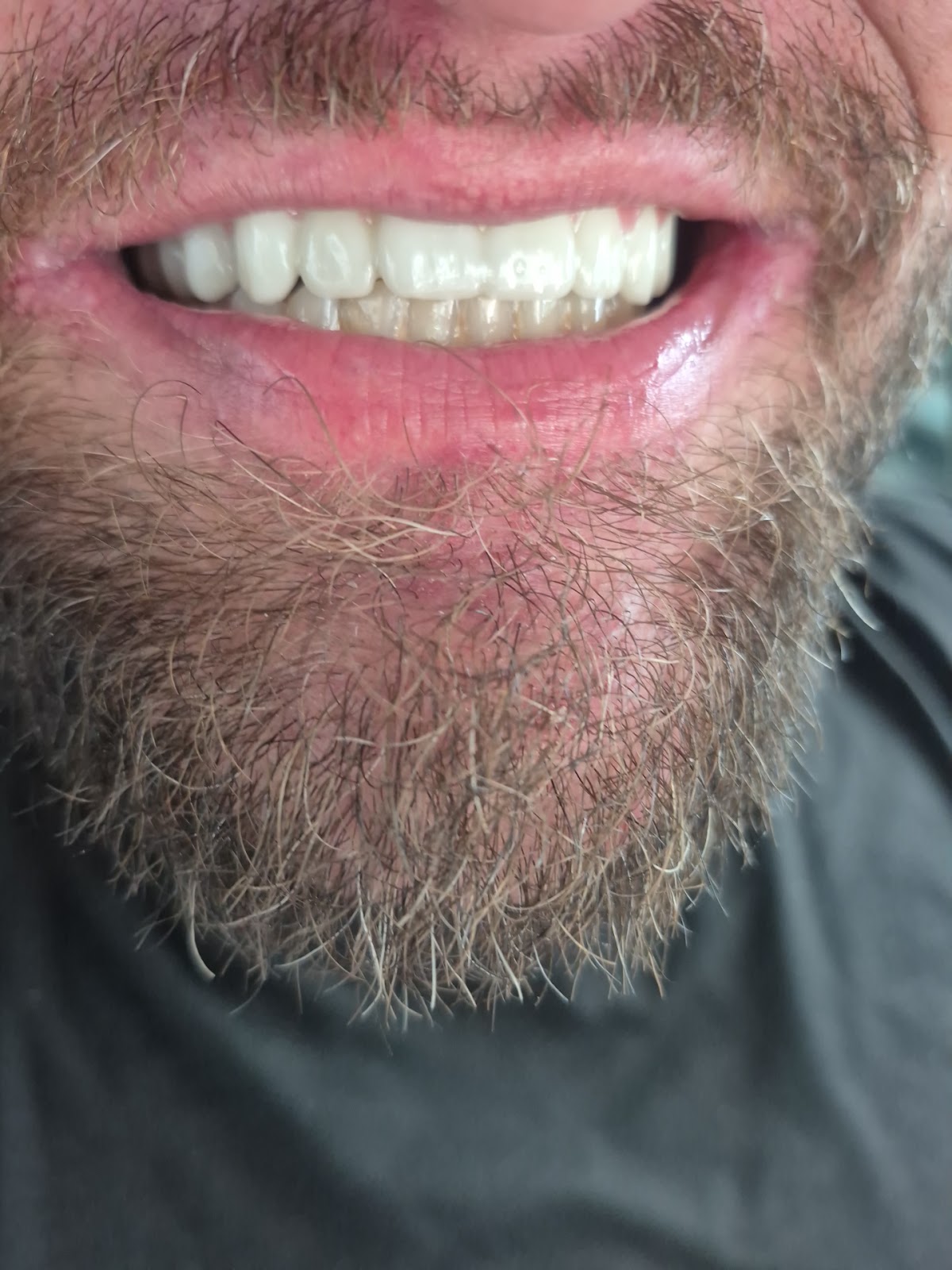 Newme Dental Implants of Houston photo 3