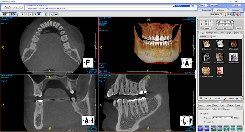 Auburn Dental Care photo 6