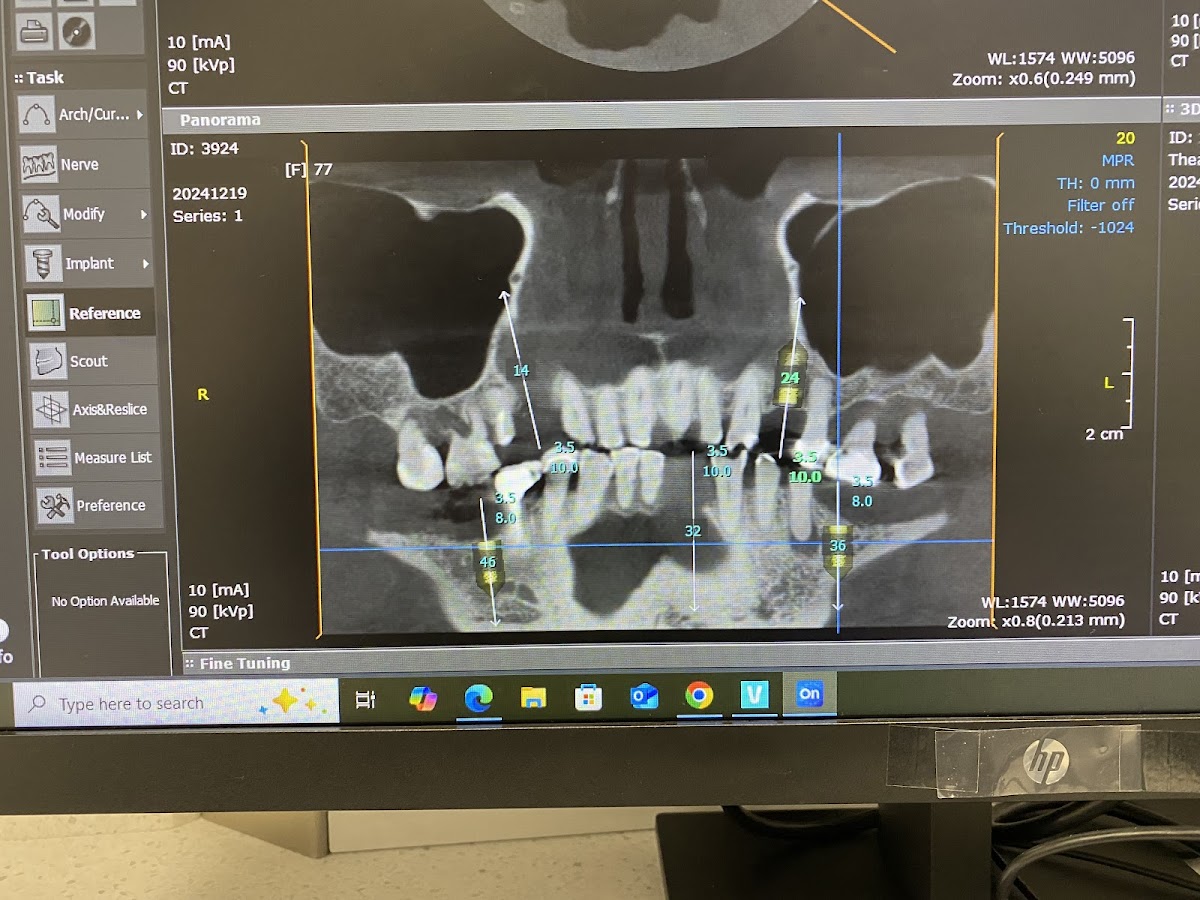 Innovo Dental and Implant Studio Livermore photo 4