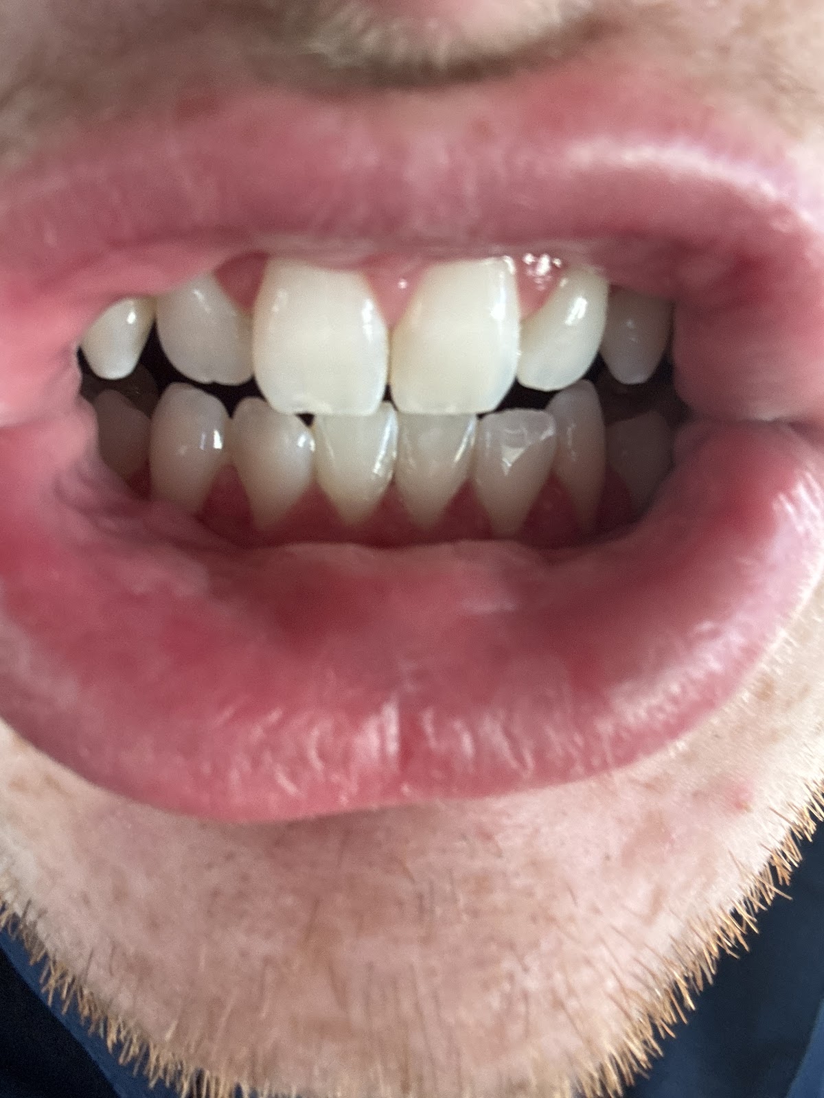 Aspen Dental - Brenham photo 4