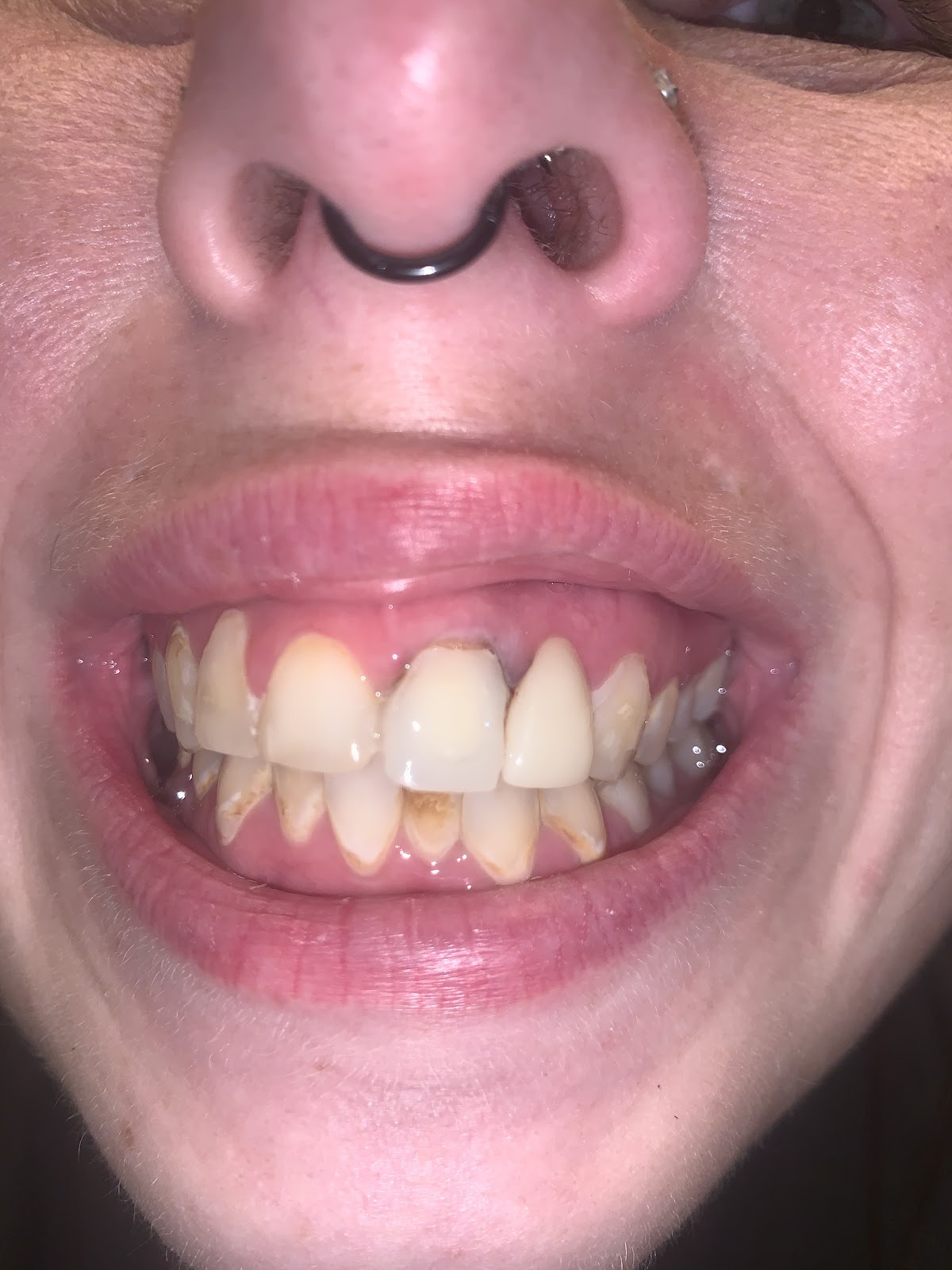 Aspen Dental - Leesburg photo 4