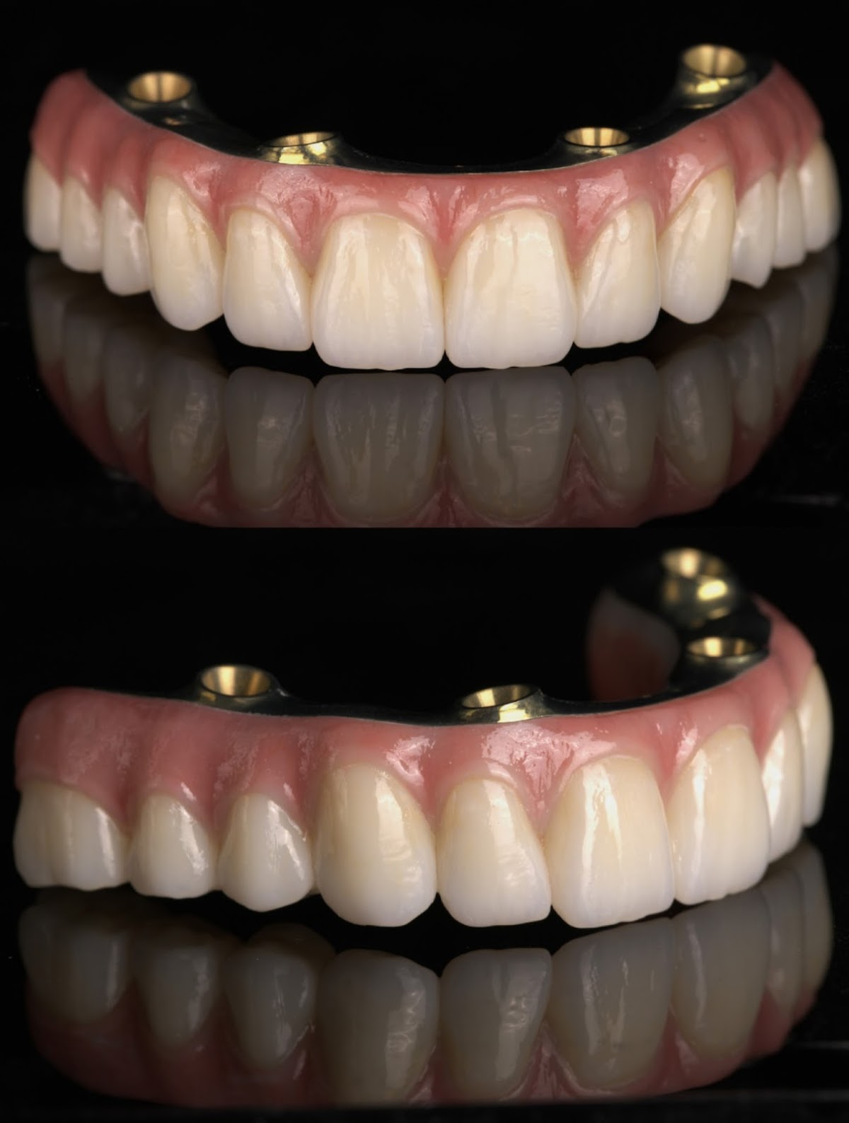 Bend Prosthodontics photo 4