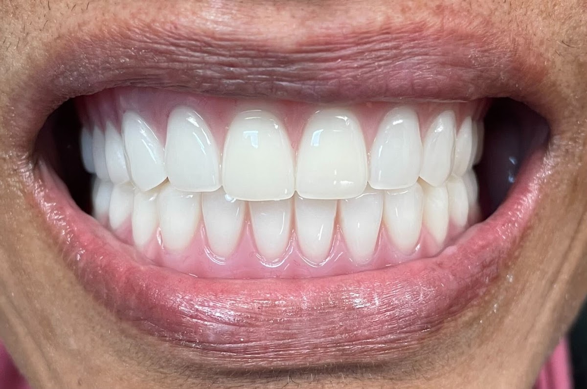Titanium Dental photo 1