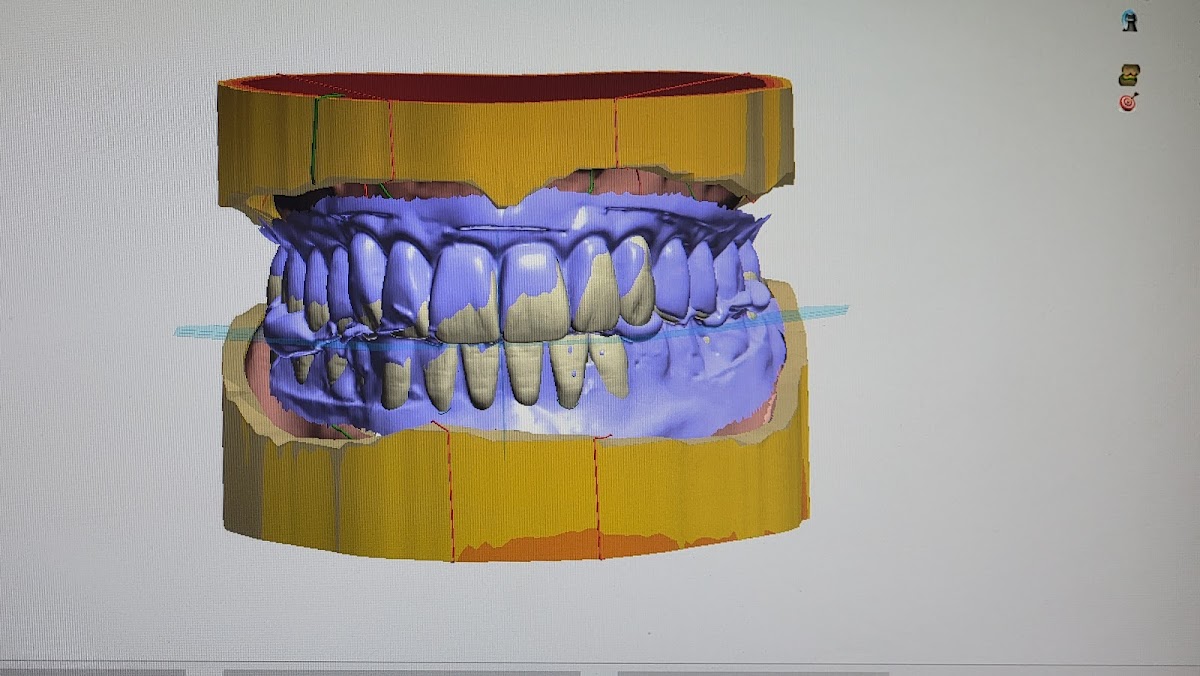 Central Maine Denture: Patrick Allen, Ld photo 2