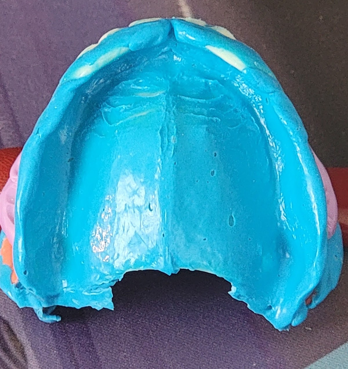 Central Maine Denture: Patrick Allen, Ld photo 4