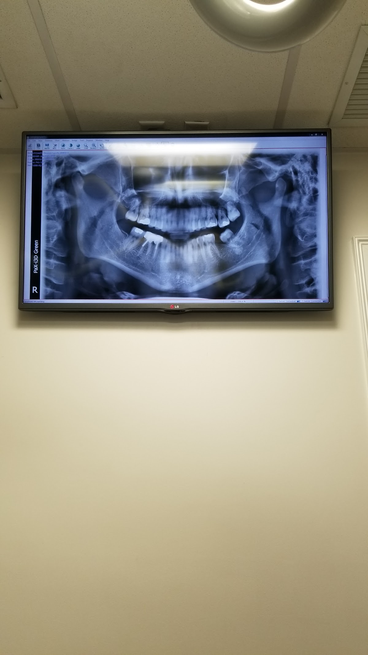 Plantation Oral Surgery and Dental Implants photo 4