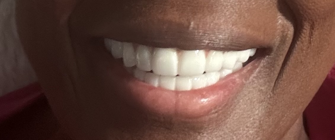 Ace Dental Center - Chicago photo 5