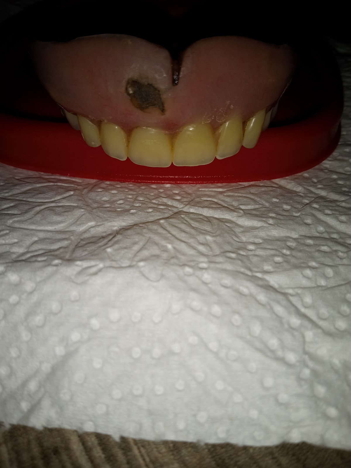 Aspen Dental - Owings Mills photo 4