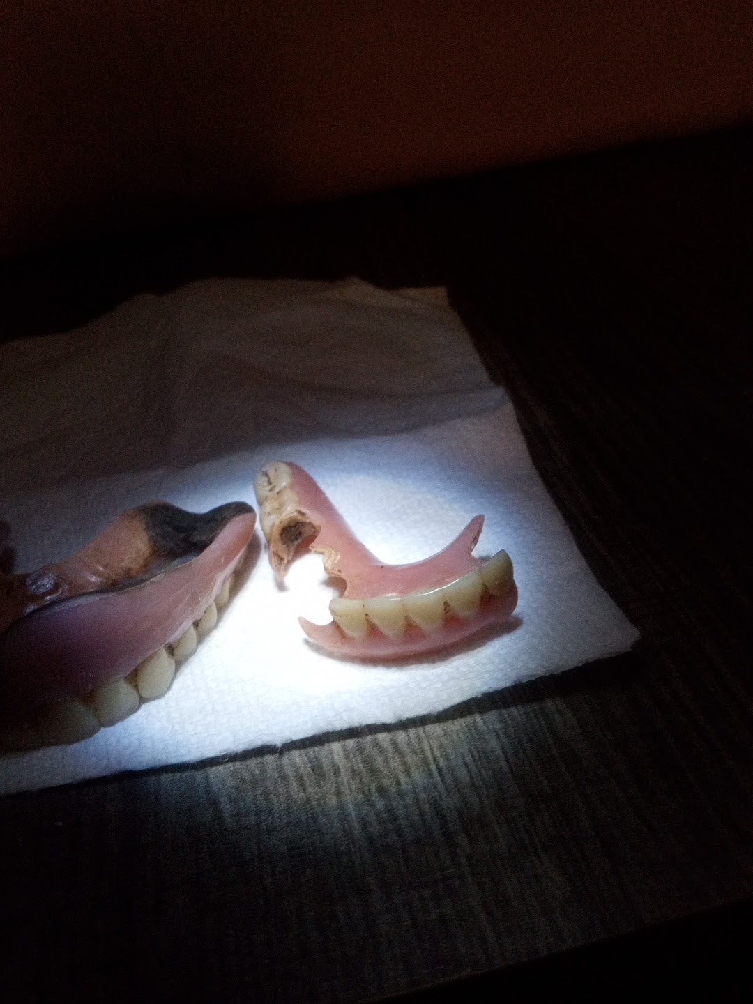 Aspen Dental - Owings Mills photo 5