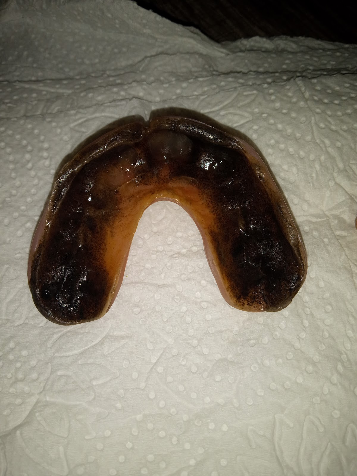 Aspen Dental - Owings Mills photo 6