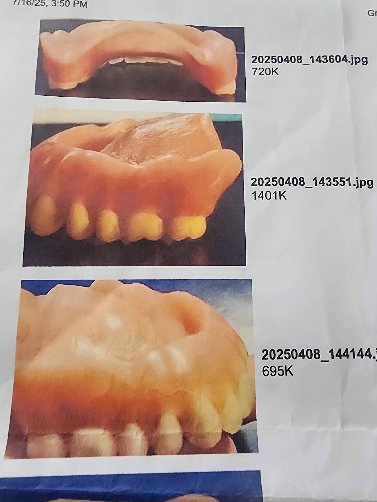 Aspen Dental - Culpeper photo 3