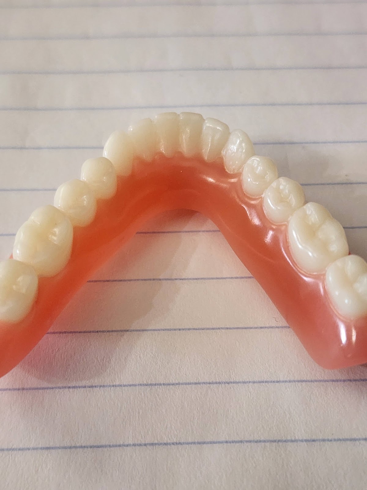 Aspen Dental - Culpeper photo 5