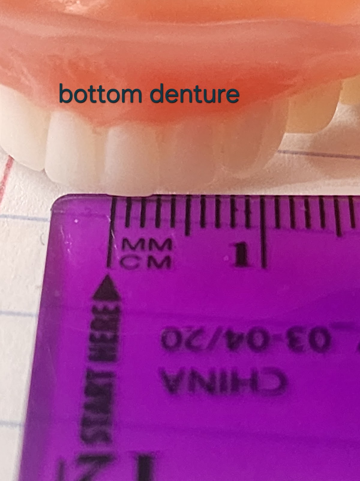 Aspen Dental - Culpeper photo 6