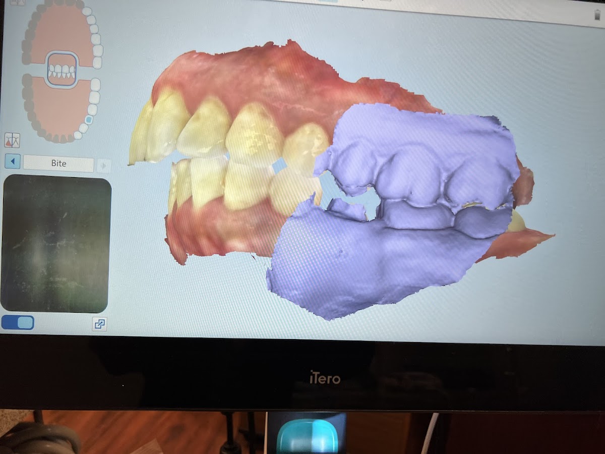 Tyer Family Dentistry photo 1