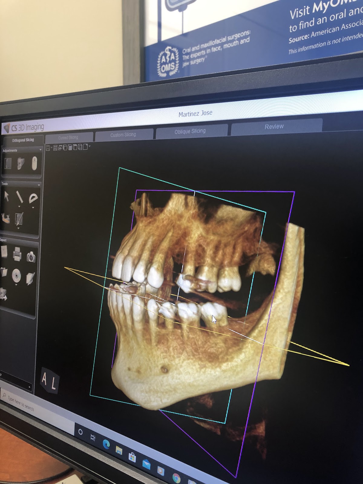 Rai Oral Surgery and Dental Implants photo 5
