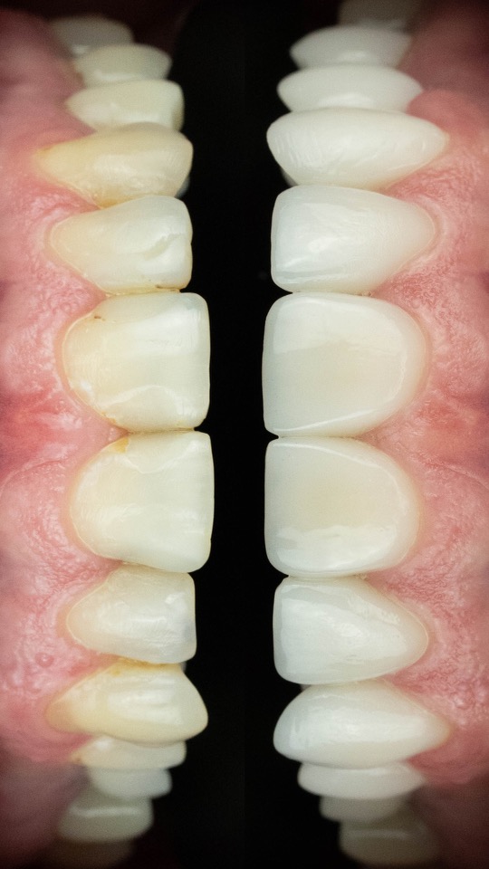 Pearce Dental Group of Cincinnati, Oh photo 2