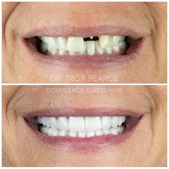Pearce Dental Group of Cincinnati, Oh photo 3