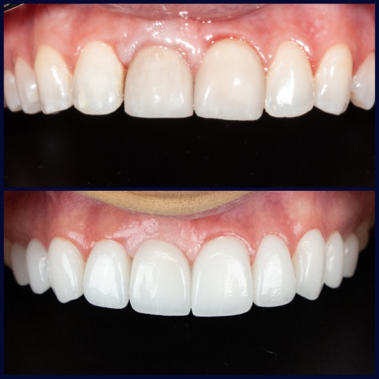 Pearce Dental Group of Cincinnati, Oh photo 4