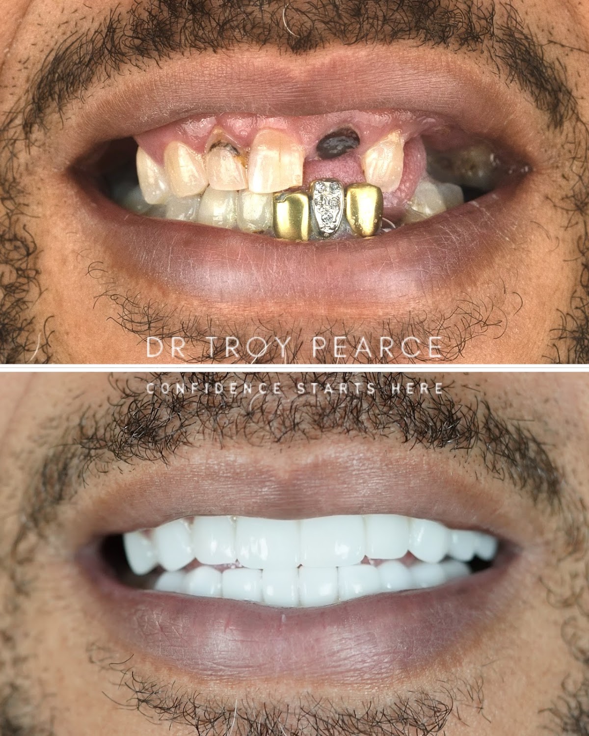 Pearce Dental Group of Cincinnati, Oh photo 5