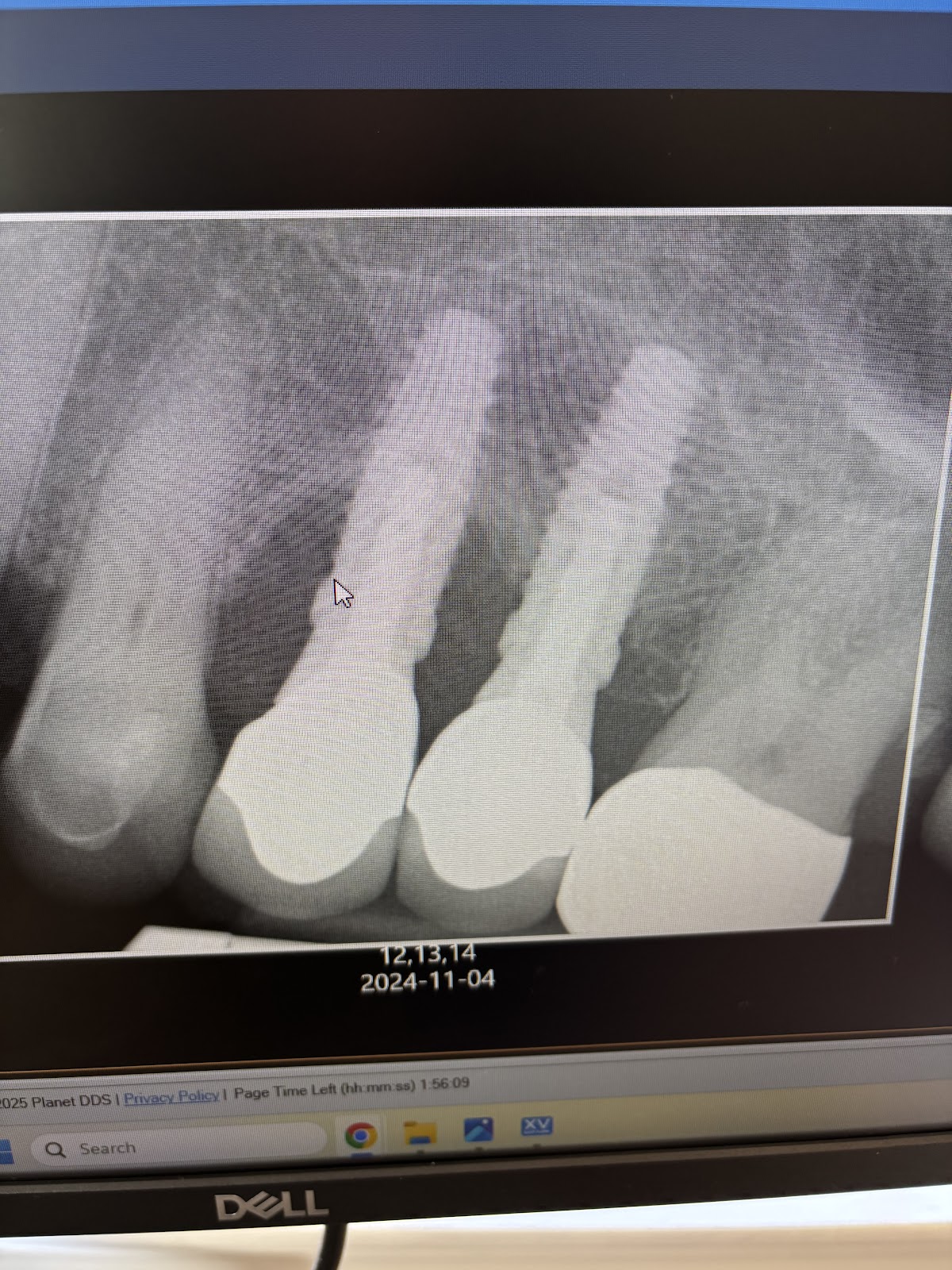 Shoreline Periodontics: Dr. Gregory A. Toback & Dr. Lavanya Rajendran photo 5