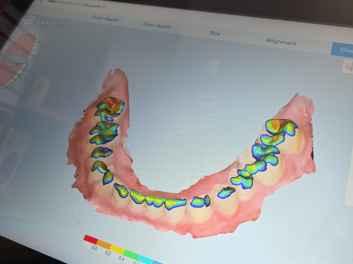 Dental Care of Edmond photo 4