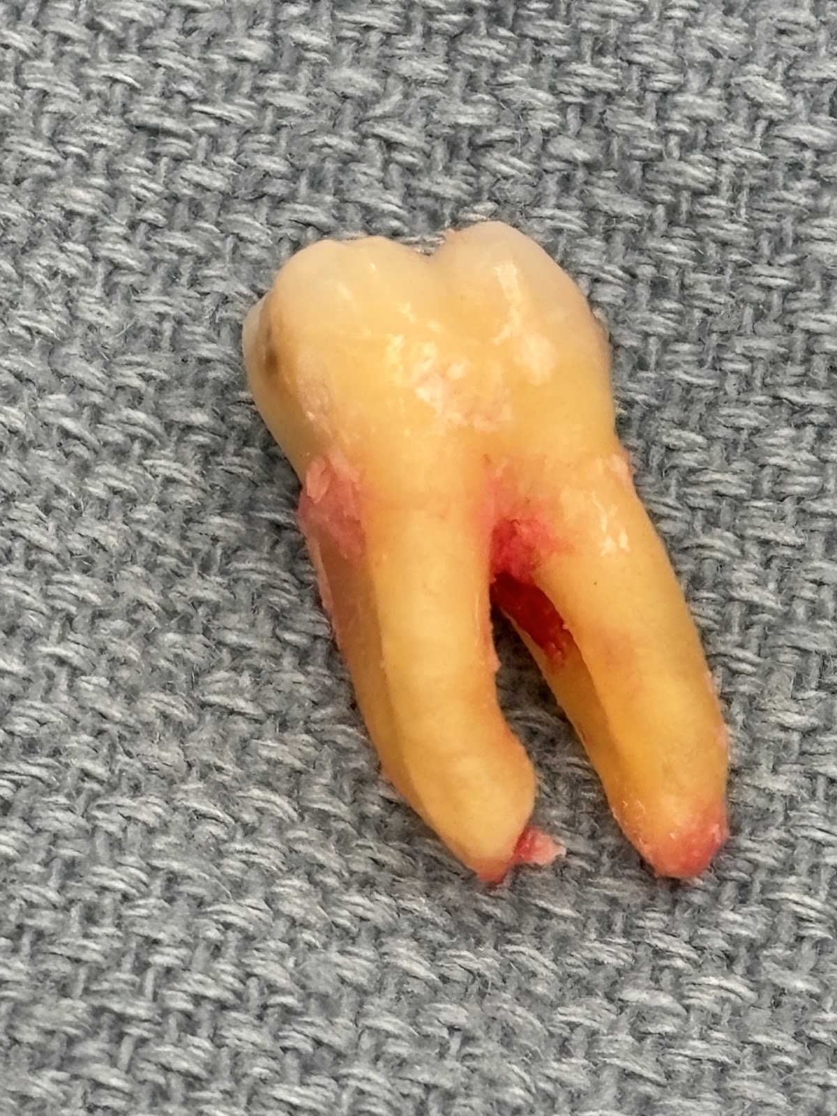 Dental Care of Edmond photo 5
