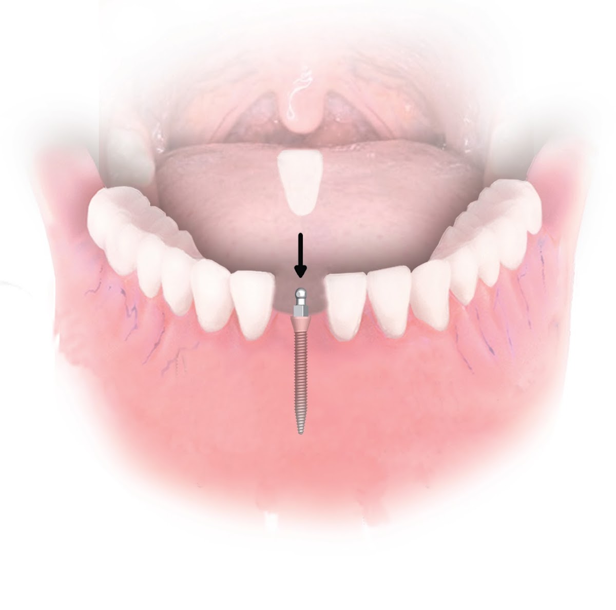 Dental Implant Solutions photo 1