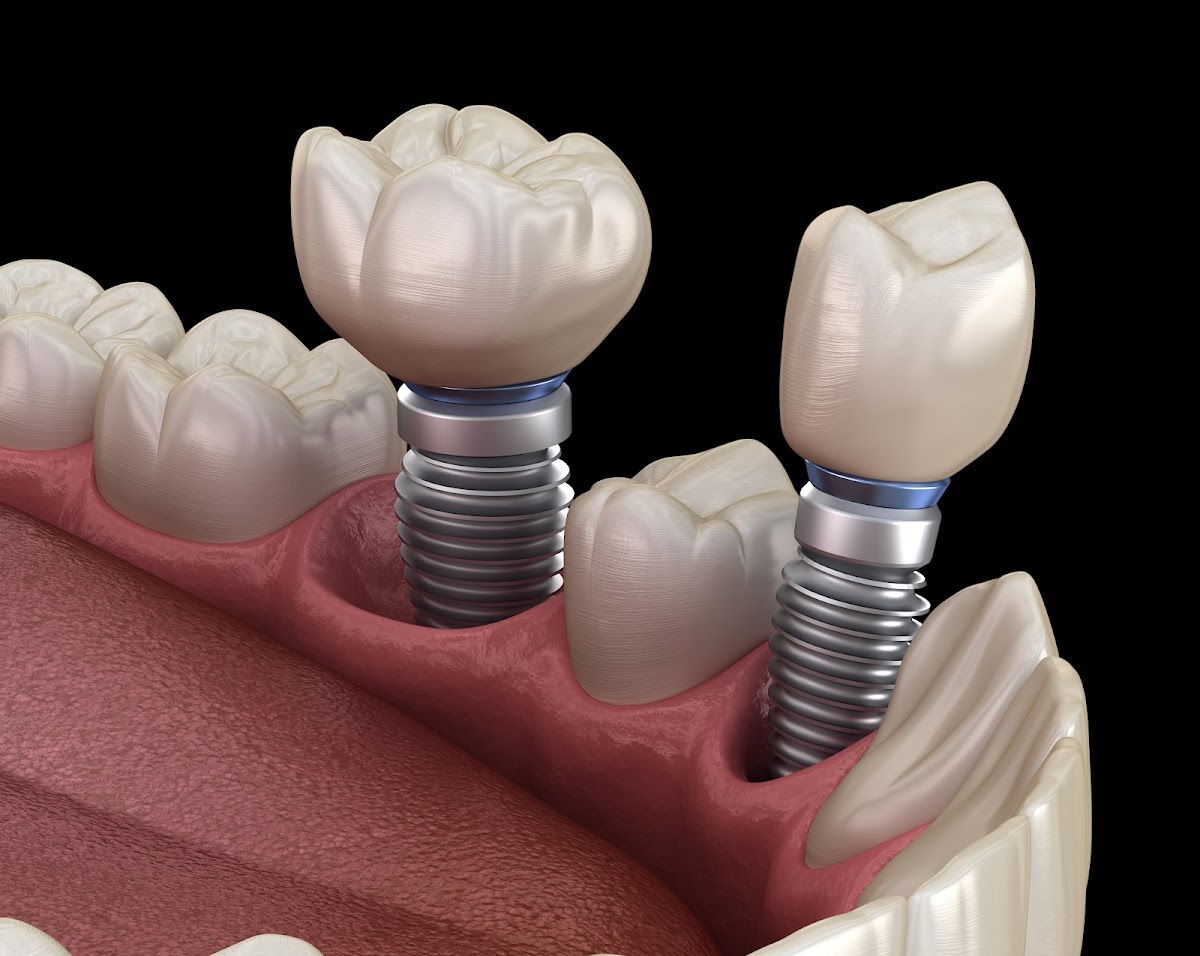 Mccracken Family Dentistry photo 2