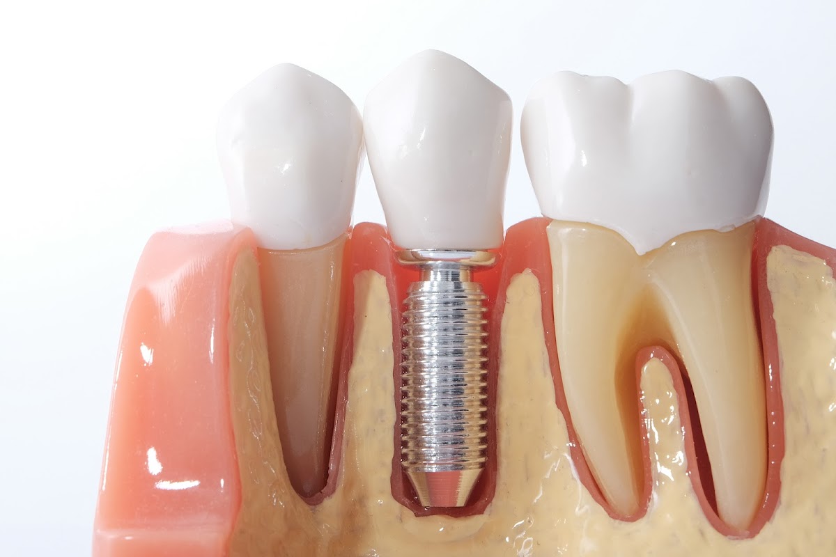 Mccracken Family Dentistry photo 3