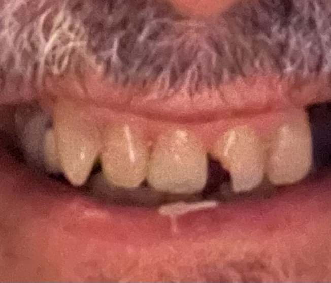 Aspen Dental - Rome photo 5