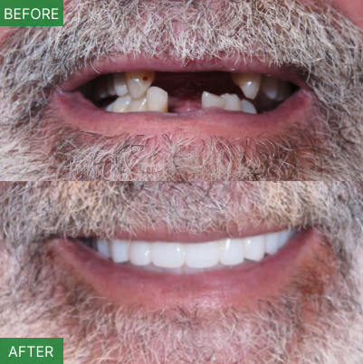 Nj Implant Dentist – Dr. Arnold Do | All-on-4 & Full Arch Expert photo 1
